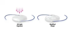light-adjustable-lenses light-adjustable-lenses