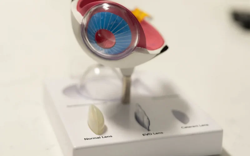 eye model showing a normal lens, EVO lens and cataract lens